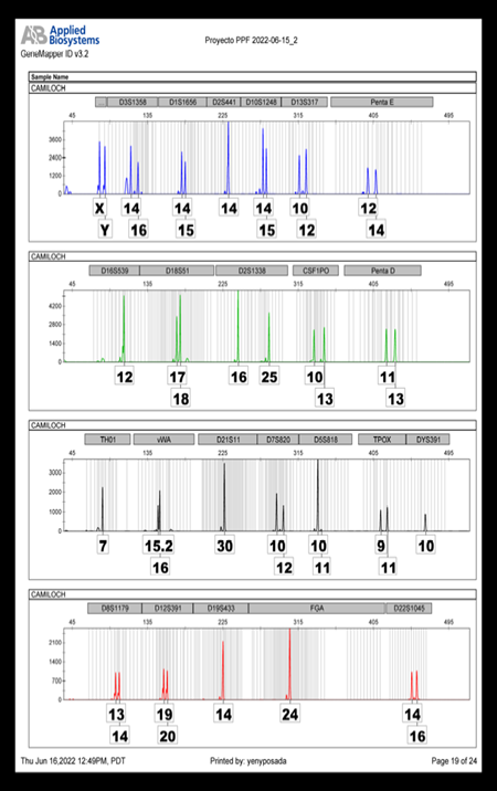 Figure 1: Electropherogram of a genetic pattern obtained from the extraction of a temporary tooth, carried out with ChargeSwitch Forensic DNA Purification Kit.