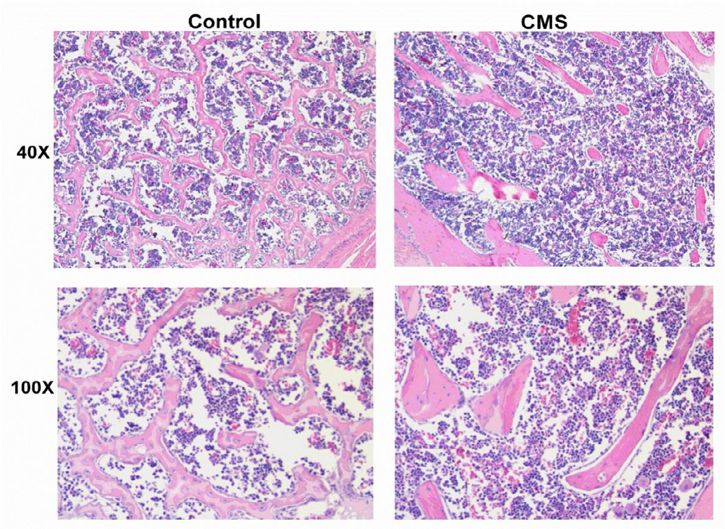 Figure 7: HE staining pattern of liver macrophages in two rat models.