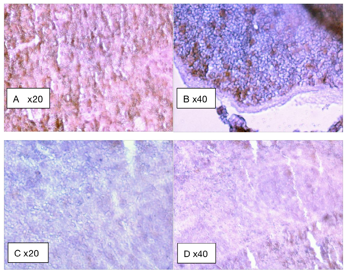 Figure 8: Experimental CMS groups A and B; control groups C and D. Immunohistochemical plots of spleen macrophages in two rat models.