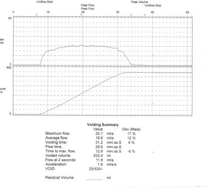 Figure 6: Uroflow study post operative.