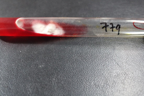 Figure 2: Direct microsopic examination (KOH) showing branched septate hyphae Figure 3: Culture of _M. audouinii_ on DTM with white radiating surface and.The medium turned to red.