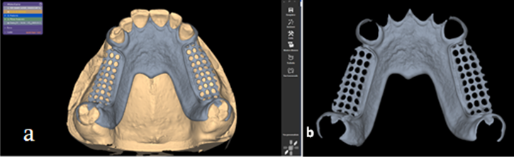 Figure 6: a. Digital designing of the virtual framework; b. Checking of the virtual framework.