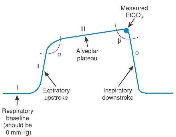 Figure 2: Expiratory limb: Phase I – CO2 from anatomic dead space; Phase II – transition from dead space to alveolar gas; Alpha angle – between Phase II and III is indirect indicator of V/Q status; Phase III – CO2 from alveoli; Inspiratory limb: Beta angle – between Phase III and inspiratory down stroke; Phase O – Beginning of next inspiratory cycle. The most common causes of inspired CO2 seen in capnogram are as follows: