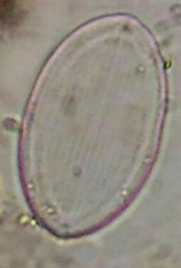 Figure 2: Cocconeis.
