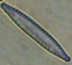 Figure 4: Diatoma.