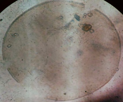 Figure 5: Discostella.