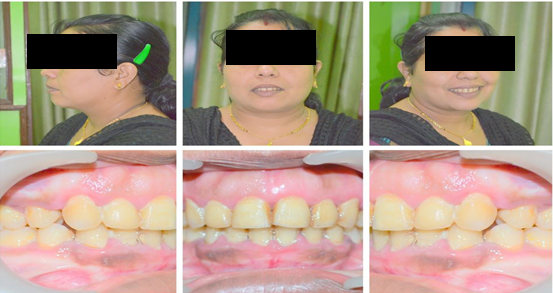 Figure 7: Comparison with lateral cephalograms.