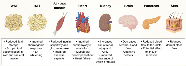 Figure 3: Courtesy ref no -27-Consequences of obesity-induced capillary rarefaction on tissue function. White adipose tissue (WAT), brown adipose tissue (BAT), chronic kidney disease (CKD).