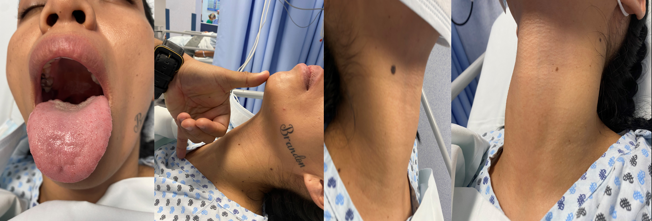 Figure 1: Physical examination using El- Ganzouri Risk Index (EGRI).