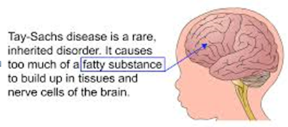 Figure 7: Tay-Sachs.