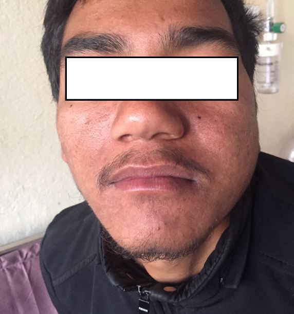 Figure 1: Pre-Operative Image of Patient.