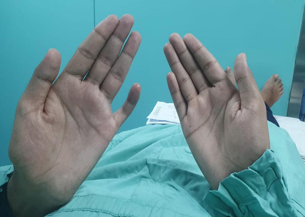 Figure 6: Physical examination findings after the procedure.
