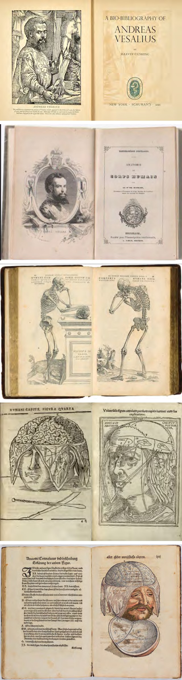 Figure 2: Books on anatomy belonging to Ambroise Paré.