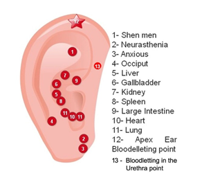 Figure 8: Auricular acupuncture.