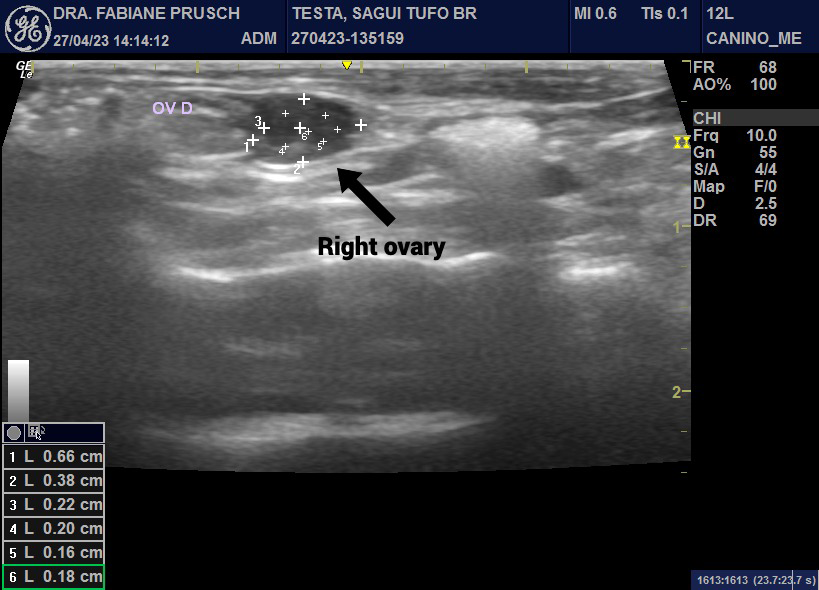 Figure 1: Black dot indicating the right ovary with cysts at the abdominal ultrasound.