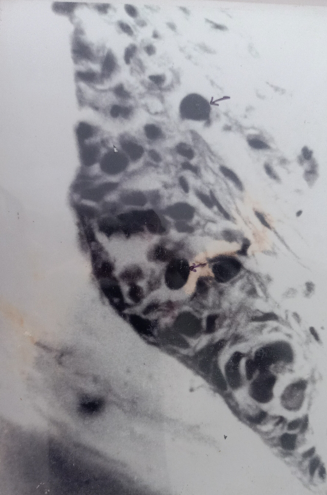 Figure 10: Showing the Stomach wall with Intranuclear Inclusion Bodies with a Reduced Cytoplasm in Tiger Prawn enaeus monodon by white spot syndrome virus (WSSV).