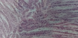 Figure 3: Showing the Infected Region of The Gill By Suspected WSSV in Penaeus monodon.