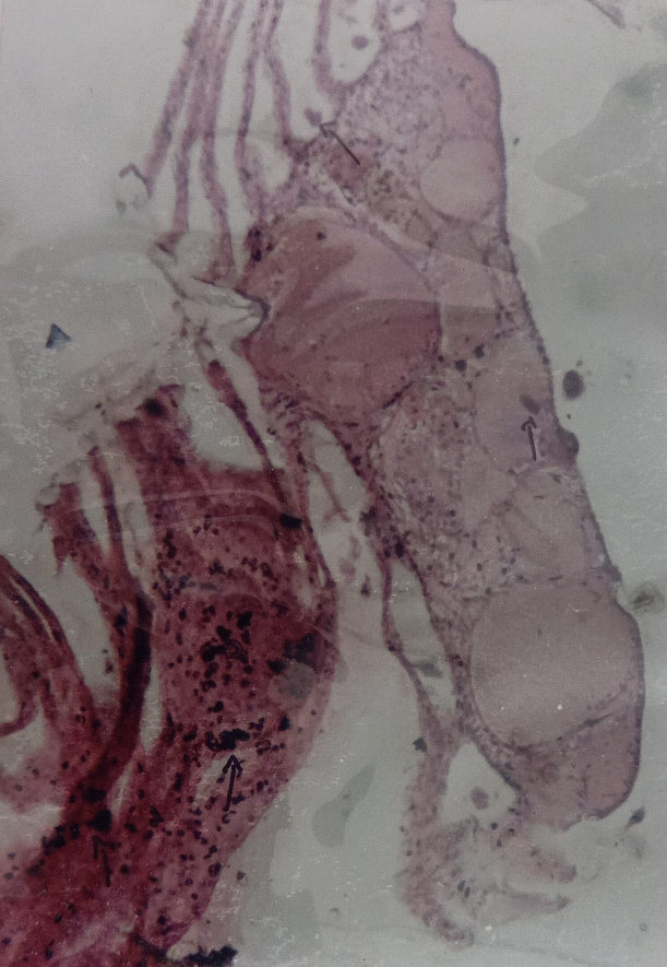 Figure 8: Showing the Cross Section of Infected Region of Eye Tissue in Penaeus monodon.