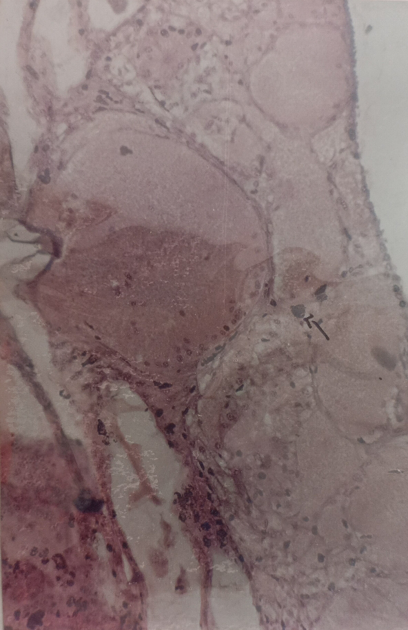 Figure 9: Showing the Cross Section of Eye Tissue in Penaeus monodon.