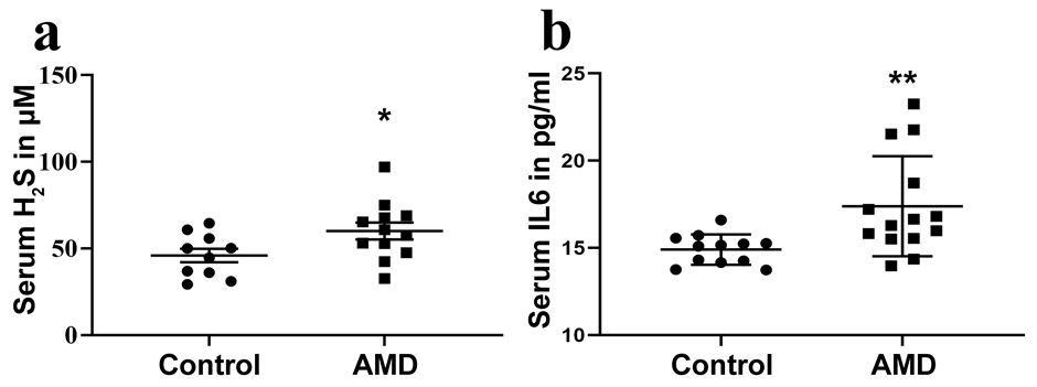 Figure 1: Estimation of serum H2S and IL6 in AMD cases: a) Serum H2S by methylene blue method. b) Serum IL6 levels measured using ELISA.
