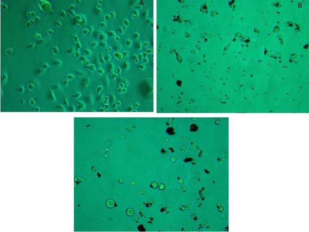Figure 7: Internalization of green nanoparticle in MCF-7 cell line (A) Control; (B and C) treated green nanoparticle.