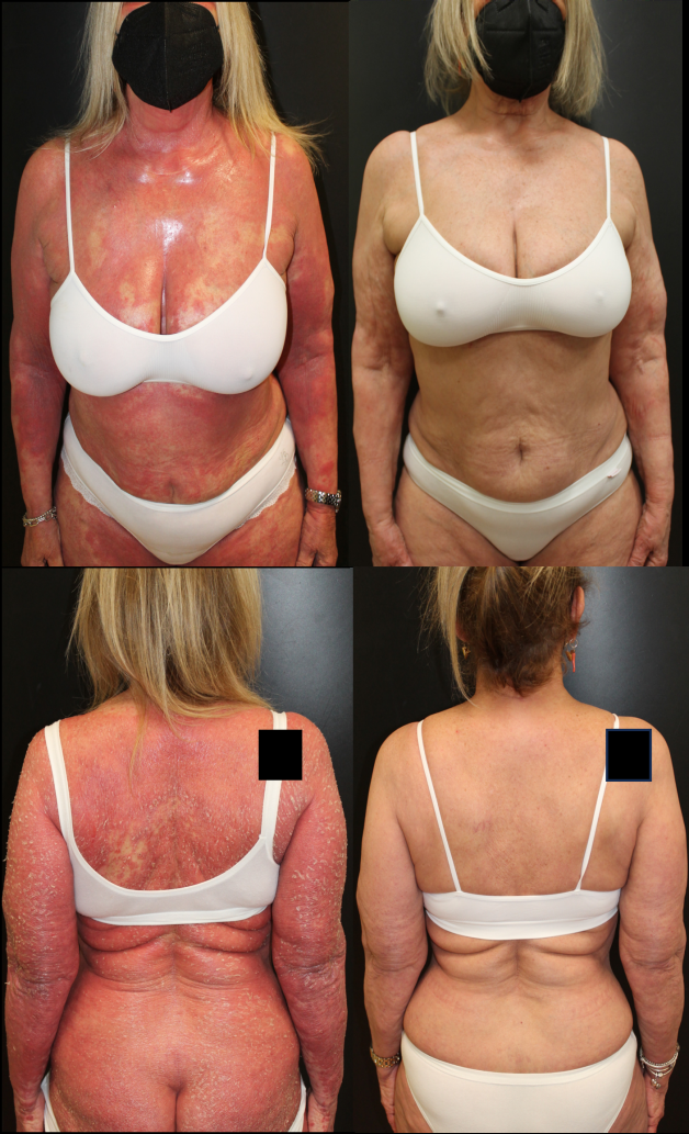 Figure 4: Comparison after treatment.