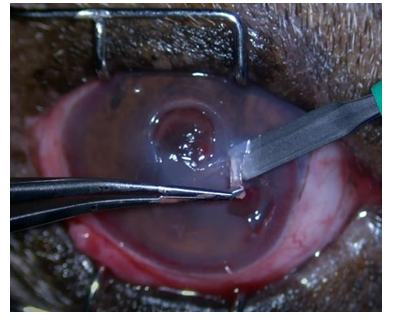 Figure 3: The advantages described by Gelatt KN, et al. [2] are the vision is maintained while the graft is in place, the technique is performed to cover any part of the cornea, the graft moves in relation to the globe and no tension is created with the movement of the eyelid, and being able to perform the application of topical medication. It was recommended to patients with the aim of providing rapid healing and maintaining preserved vision, since the cornea is a segment that does not have a blood supply, and therefore, its healing is slow even with antibiotic therapy, and in the case of easily ruptured ulcers, it can lead to loss of vision by compromising the posterior segment, and even in enucleation.