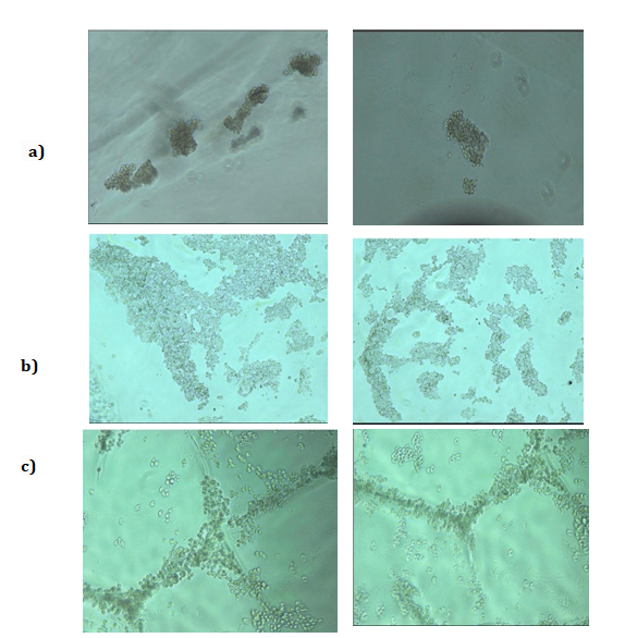 Figure 7: Microscope Images of a) AM/AMPS (0) b) AM/AMPS (60) c) AM/AMPS (300) hydrogels, respectively.