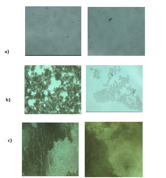 Figure 8: Microscope Images of a) AM/CMC/AMPS (0) b) AM/CMC/AMPS (60) c) AM/CMC/AMPS (300) hydrogels, respectively.