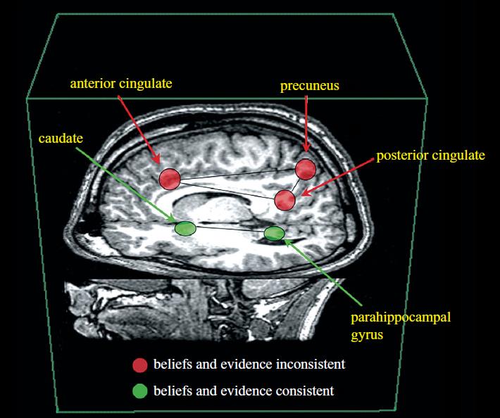 Figure 2: (A graphical depiction of a brain-based model displaying the two dissociated networks involved with belief and evidence integration in causal reasoning.)[31]. Nowadays, fMRI is almost the most satisfactory way for neuro-litigation. It should be acknowledge that interfering neuro-evidence in judicial procedure as a component of litigation evidence could rather clarify proposed case in court by imposing the details; by which judge could decide more sound. For instance, in 2010 the first Dauber hearing was held on the basis of neuroscientific evidences, specifically fMRI lie-detection evidence, for sentencing argumentatively [32]. These neuroscientific technologies could be applied as a way to discovering “dangerous mind” in order to preventing violations or dealing with criminals. However, neuroscientific tests’ results do not absolutely imply to the reality but, as a matter of fact, its leading data for clarifying the truth in a more significant way is undeniable; these data, as well as, other subject matters (Data, documents, evidences and so on) could be outstandingly helpful for judge’s knowledge [33,34]. Among neuroscience’s usages, one of the controversial issues is investigation on the brain of suspect of terrorism as a measure to maintain public security. Is public security a convincing legitimate justification for this experimentation? This leads to a multi-dimensional analysis in which various norms are implicated. In a general vision, it falls into the realm of human right and public law with neurolaw as the common factor. In this regard, we are specifically confronting “right to privacy” and “right to cognitive liberty” on the one hand, and “public security” on the other hand.