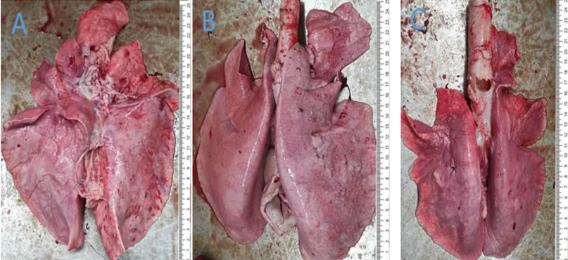 Figure 1: Lungs suspected of adenocarcinoma.