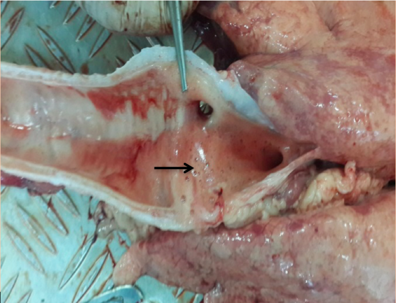 Figure 3: The presence of foamy liquid in the trachea.