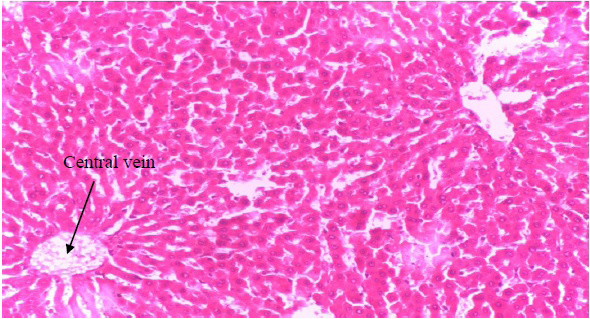Figure 6: Photomicrograph of liver section of rat administered ethanolic extract of unriped fruit of Dennettia tripetala (200mg/ kg) (Group 4).