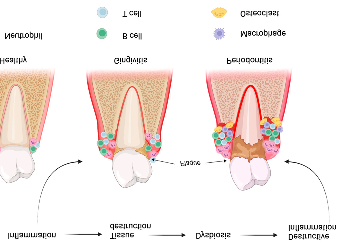 Figure 1: Prior to sampling supra gingival deposits were removed with sterile cotton pellets without touching the marginal gingival, and the sample sites were isolated with cotton rolls and the reticular site was then dried gently with a syringe. Standardized paper points (META BIOMED Co Ltd, Korea R) size #30 were inserted into the crevice until mild resistance was felt. The paper points were left in pocket for 30 seconds. Paper points which were contaminated with blood and saliva were discarded The collected GCF samples were immediately pooled and diluted in phosphate buffer saline up to 600 μl (PBS; 137 m NaCl, 10 mm Na2HPO4 and 2.7 mm KCl ; pH 7.3) in Eppendorf tube and transported to the lab Figure 2. The samples were frozen at -80°C till they were assayed for RANKL evaluation.