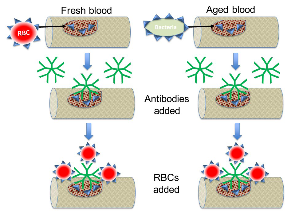 Figure 1: Mixed Agglutinin Method for Forward Typing of Fresh Vs Aged Samples.