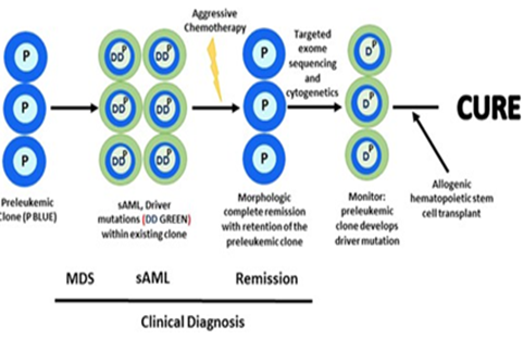 Figure 4: In evolution of MDS in the figure, after secondary AML the remission is happened [1,2] and the patient is cured, but why and how?