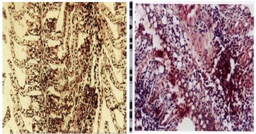 Figure 10: The gills of tilapia appear in areas heavily contaminated with heavy metals, showing lamellar necrosis [135].