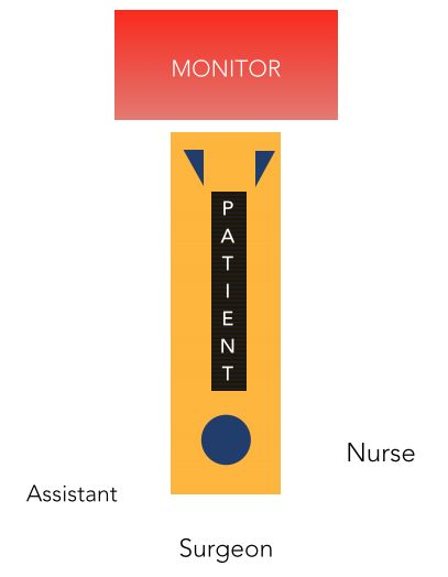 Figure 1: Surgical asepsis using iodine based product eye protection was performed.