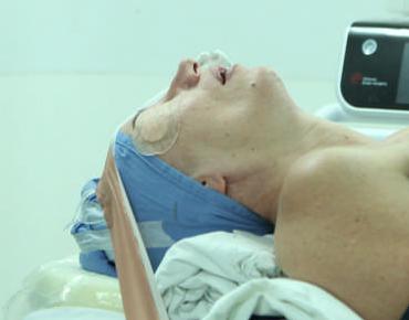 Figure 2: position of patient with neck hyperextension, in supine position.