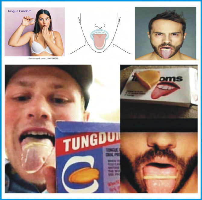 Figure 11: Tongue condom design in the form of regular/traditional penis condoms [42-45].