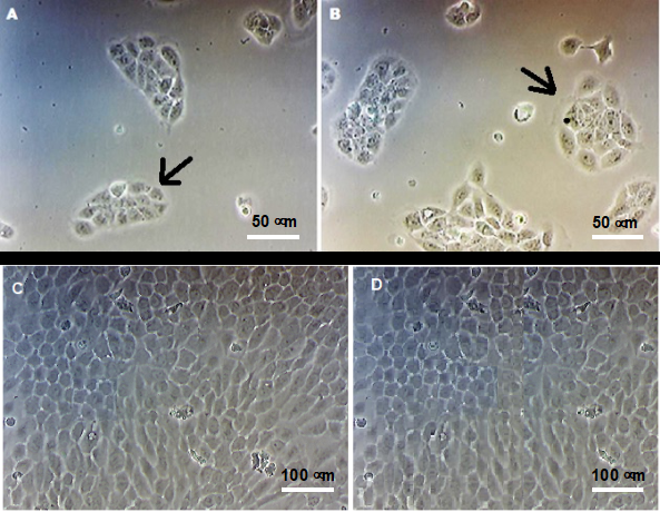 Figure 1: Morphology of HaCaT cells evaluated by optical microscopy. HaCaT keratinocytes were cultured in the absence (A and C) or in the presence of 25 µM ZnCl2 (B and D), for 24 h (A and C) and 5 days (C and D). The black arrows indicate the characteristic colonies of keratinocytes in culture. No phenotypic differences were observed between cultures in the presence of zinc ions. Magnification of 400 x (A and B) and 100 x (C and D).