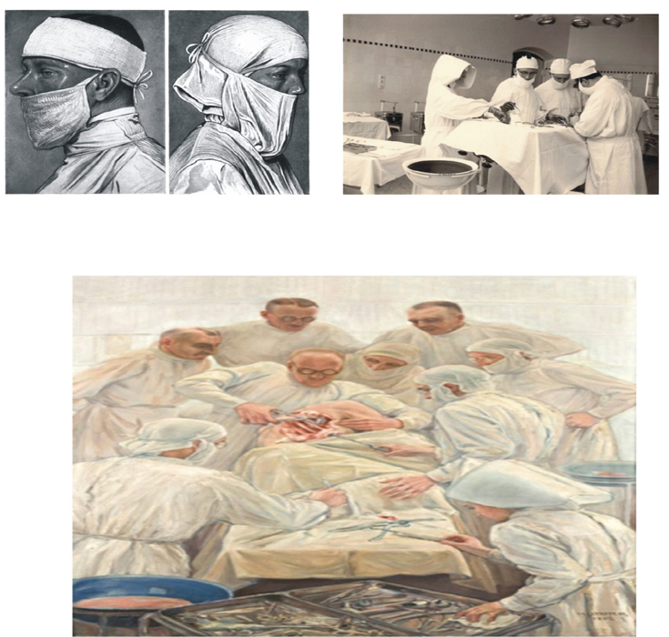 Figure 23: The precursor to modern surgical mask being used in the operating rooms of Germany and the USA in the 1920s [71-73].