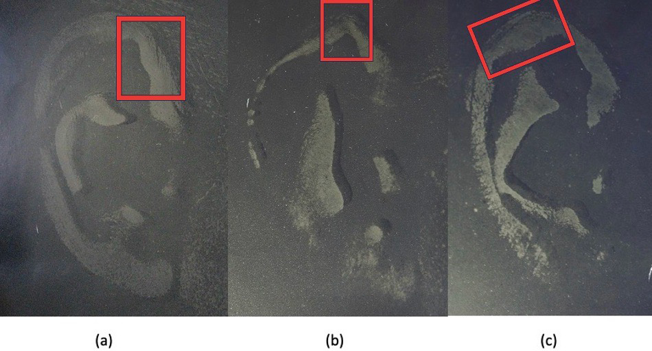 Figure 2: Darwin’s Tubercle (A) Nodosity (B) Projection (C) Enlargement.