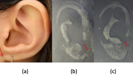 Figure 5: Ear Lobe Attachments (A) Attached (B) Partially Attached (C) Free.