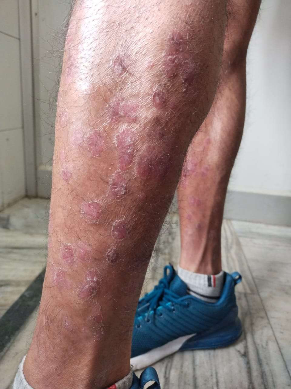 Figure 1: ** Before treatment.