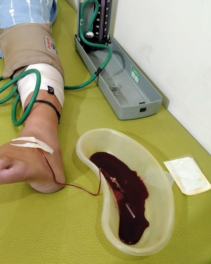 Figure 1: A tourniquet was tied at the calf region and, under aseptic conditions, the vein near the right heel and ankle joint was identified. 40cc of blood was drawn using a scalp vein set. The patient was observed for one hour. The same procedure was carried out on the left foot after each week for 1 month.