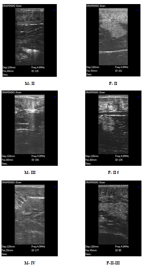 Figure 3: Ultrasound images of frontal sections of Beluga (_Huso huso L_.) M: male at the maturity stage II (M- II), stage III (M- III), stage IV (M- IV); female at the maturity stage II (F- II), stage II fatty (F- II f), stage II-III (F-II-III).