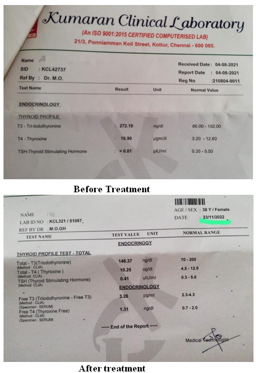 Figure 2: Changes in the levels of Thyroid hormones before and after treatment.
