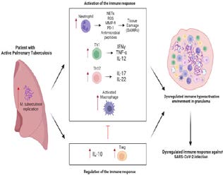 Figure 2: Demonstrating the immune response in COVID-19 and active tuberculosis. The Th1 response potentiates macrophage activity and the Th17 response favors the recruitment and activation of neutrophils with release of harmful products to the host tissue, further exacerbating the inflammatory process. To appease these responses, an elevated production of IL-10 and differentiation of Treg occurs, however, this generates a low immunologic potential. This response caused by M. tuberculosis generates an unfavorable immune microenvironment for the response against SARS-CoV-2 [2].