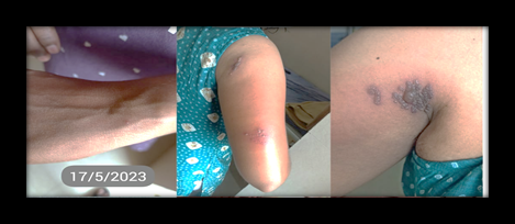 Figure 3: At the time of Discharge.